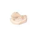 Implant Restoration Porcelain Dental Crowns
